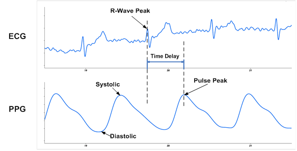rundoing n58 ecg ppg